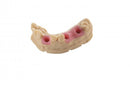BASF Ultracur Resin - DM2304 Gingiva Mask - Rosa - 1kg